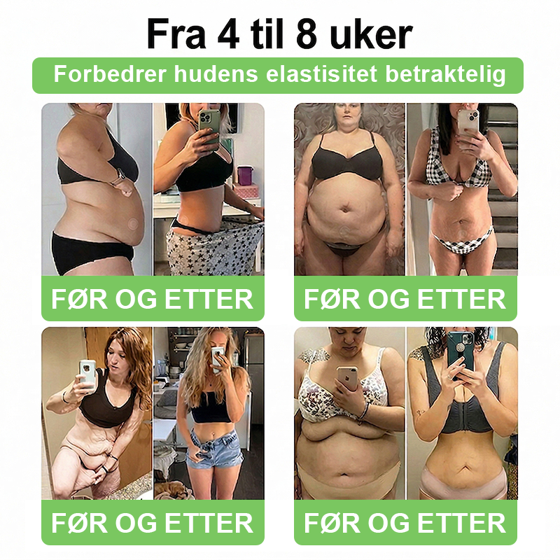 𝑨𝑴𝒁𝑲𝑬𝑬𝑷® NAD+ Nano Patch — Daglig støtte for forbrenning, energi og vektbalanse.